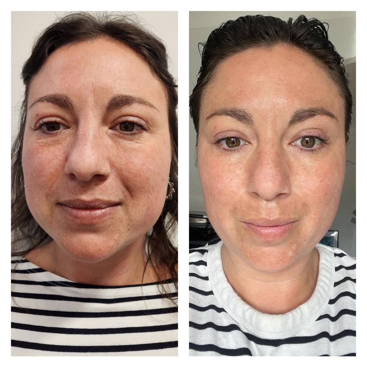 Derma 2.0 - Italian Advanced Chemical Peels