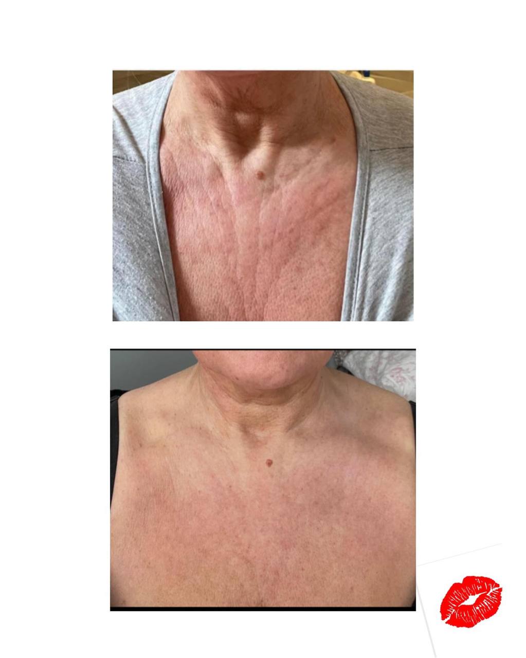 Derma 2.0 - Italian Advanced Chemical Peels