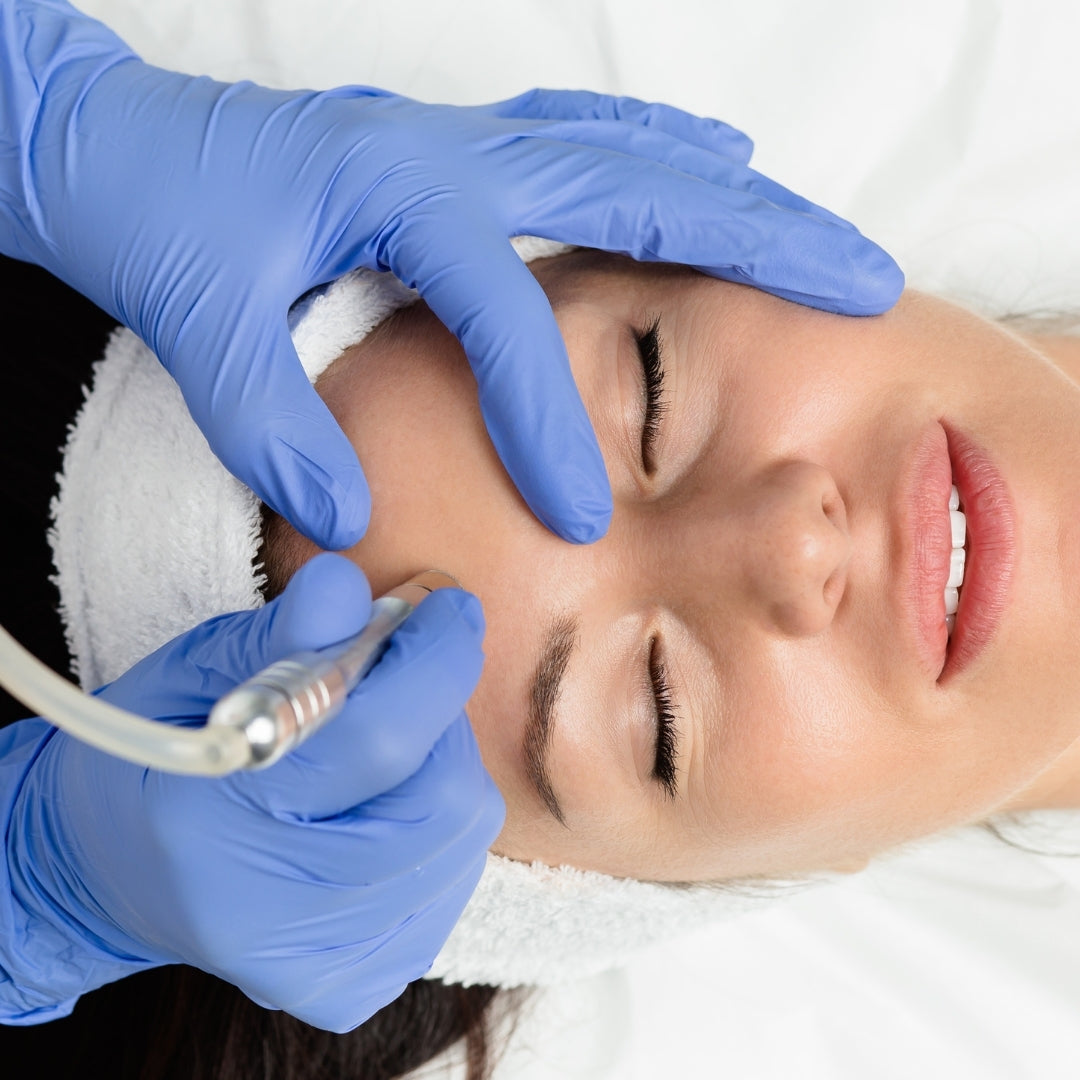 Image of a woman laying on bed receiving a dermabrasion treatment from a beauty therapist