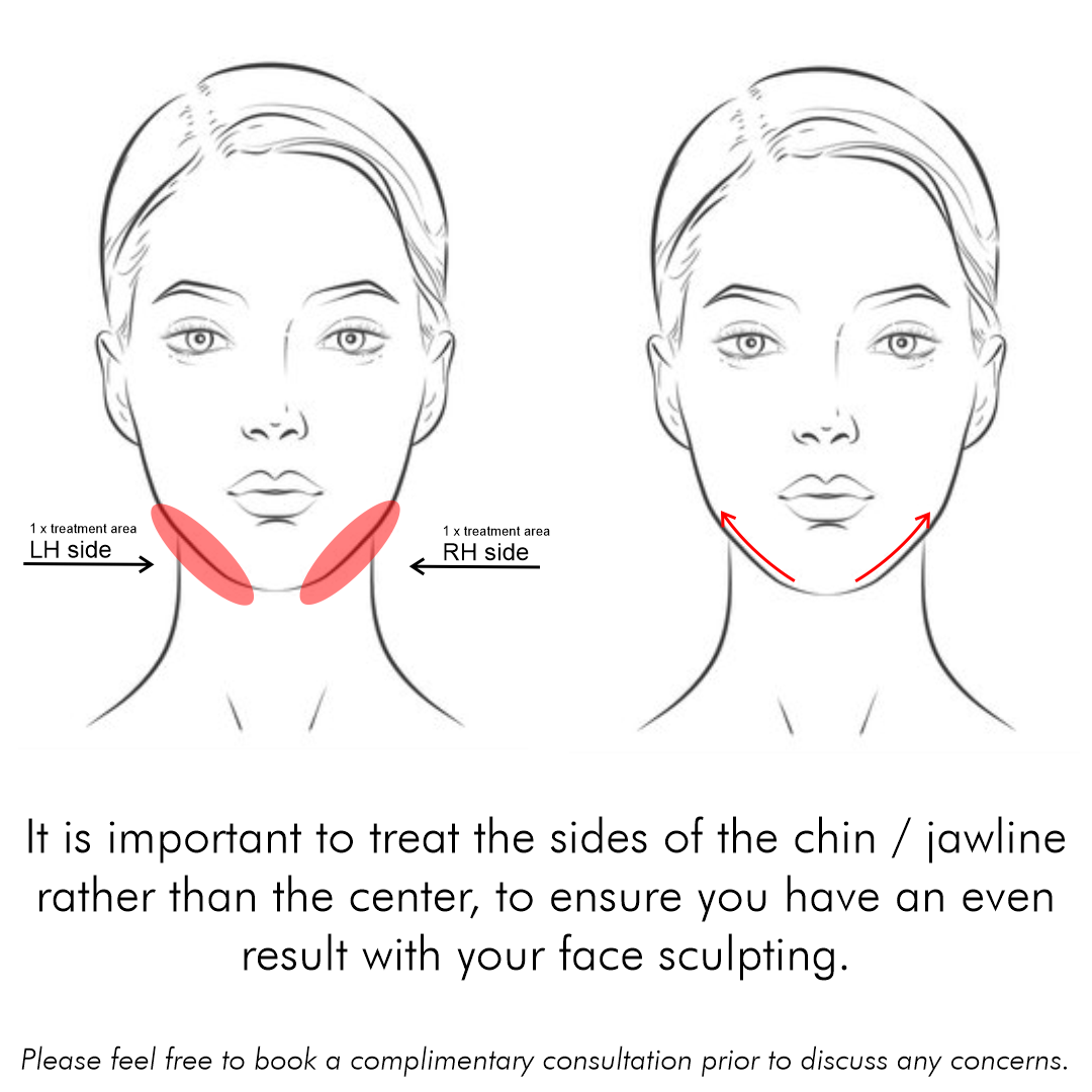 We recommend treating both sides of the chin/jawline when doing our face sculpting treatment to ensure a more even result