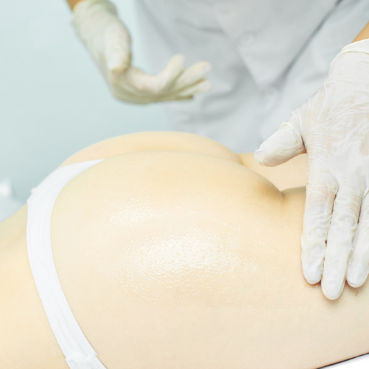 Vacuum Breast and Butt Lift Therapy at Miami Kiss Gold Coast